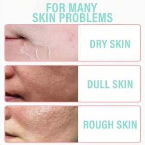 Suero para el Cuidado de la Piel con Ácido Hialurónico y Vitamina C, Humectante Líquido para Piel Seca, Normal y Mixta, Tratamiento Facial - Product Image 4