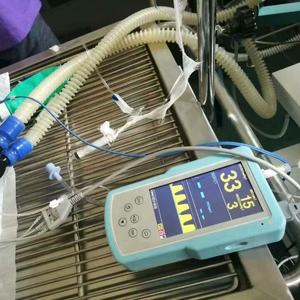 Etco2 capnografia capnógrafo dispositivo médico com etco2 linha de amostragem ambulância etco2 <span class=keywords><strong>co2</strong></span> fim <span class=keywords><strong>monitor</strong></span> maré - Product Image 2