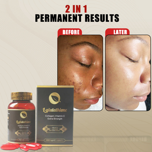 Eigen Merk Aangepaste Groothandel Glutathion <span class=keywords><strong>Whitening</strong></span> <span class=keywords><strong>Capsules</strong></span> Verminderen Melanine Antioxidant Glutathion <span class=keywords><strong>Whitening</strong></span> <span class=keywords><strong>Capsules</strong></span> - Product Image 3