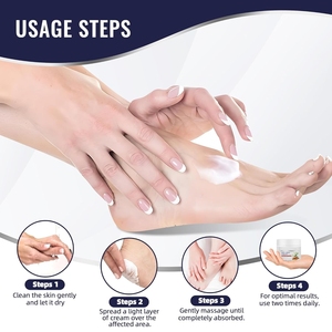 Crema de urea 40% de alta calidad de etiqueta privada, crema coreana natural para minimizar los callos, crema hidratante para reparar los pies de la piel gruesa y áspera suave - Product Image 5