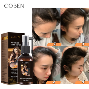 ในสต็อก!!ในสต็อก!!!100% ธรรมชาติอินทรีย์ผมเจริญเติบโตเซรั่มสเปรย์Keratin Anti Lossซ่อมแซมน้ํามันผม - Product Image 5
