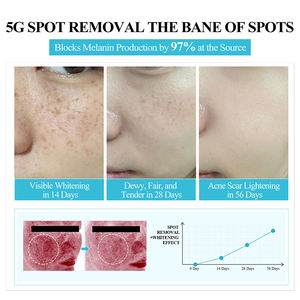 Crème pour le visage <span class=keywords><strong>anti</strong></span>-âge bio à étiquette privée, personnalisée avec votre logo, pour éliminer les taches brunes, <span class=keywords><strong>anti</strong></span>-<span class=keywords><strong>cernes</strong></span>, éclaircissante et blanchissante - Product Image 4