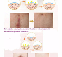 Autocollant médical souple anti-acné, 1 pièce, cache les cicatrices, bande réparatrice, étanche, pratique, bon genre de peau