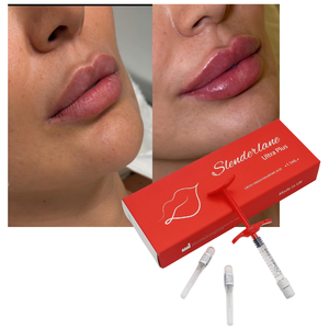 Relleno Dérmico de Ácido Hialurónico Inyectable Slenderlane a <span class=keywords><strong>Precio</strong></span> de Fábrica <span class=keywords><strong>para</strong></span> Aumento de <span class=keywords><strong>Labios</strong></span> - Product Image 1