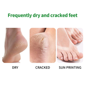 Parche Hidratante de Aloe Vera de Marca Privada, Cuidado Natural de la Piel a Base de Hierbas, Adhesivo de Hidrogel para Aliviar la Piel Seca - Product Image 2