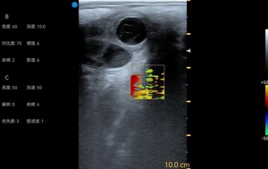 Ecógrafo Veterinario USB Usg Wifi, Instrumento para Vacas, Bovinos y Equinos, Detector de Gestación Bmv S5 Plus, Sonda Lineal Rectal USB, Ecógrafo Portátil - Product Image 5