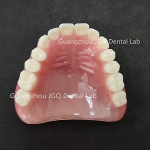 ฟันปลอมอะคริลิกคุณภาพสูงแบบสั่งทำพิเศษ ช่วยฟื้นฟูการทำงานและรูปลักษณ์ของฟันให้กลับมาเป็นธรรมชาติ - Product Image 2