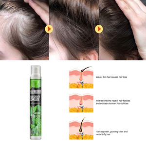 Spray per la crescita dei <span class=keywords><strong>capelli</strong></span> della <span class=keywords><strong>luna</strong></span> del sud prodotti per uomo donna olio per ricrescita rapida trattamento del cuoio capelluto dei <span class=keywords><strong>capelli</strong></span> crescita dei <span class=keywords><strong>capelli</strong></span> bellezza salute - Product Image 4