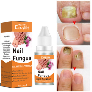 Venta al por mayor de fábrica: Tratamiento para <span class=keywords><strong>Hongos</strong></span> en las <span class=keywords><strong>Uñas</strong></span>, Eliminación de <span class=keywords><strong>Hongos</strong></span> en las <span class=keywords><strong>Uñas</strong></span>, Reparación de <span class=keywords><strong>Uñas</strong></span> - Product Image 3