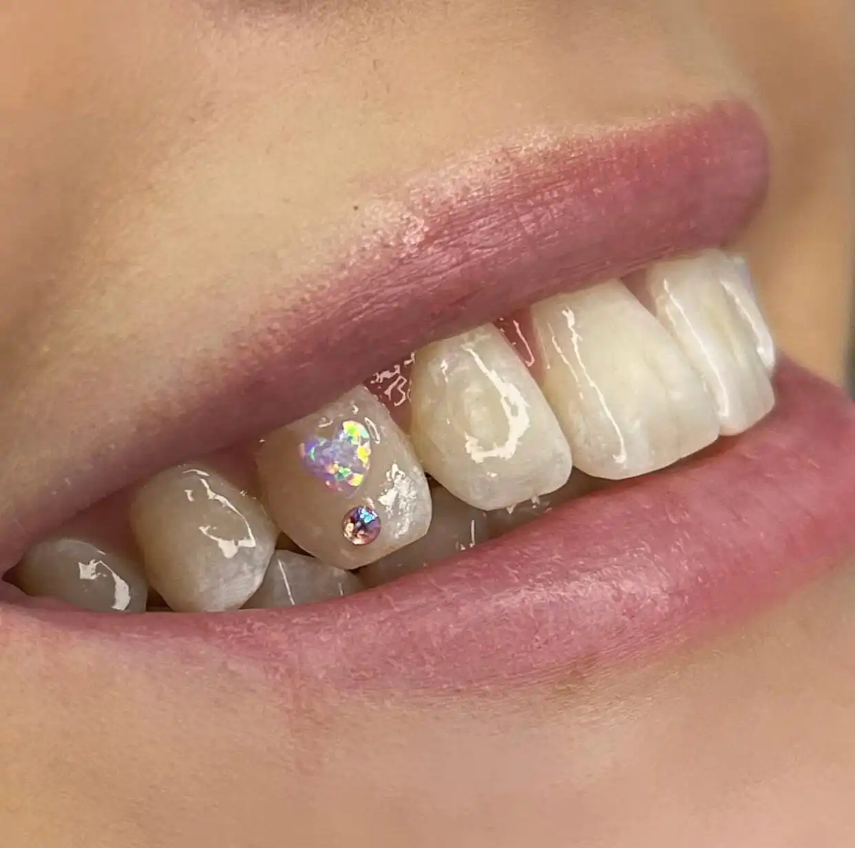 Top Quality Tooth Accessories Heart Cabochon Flat Back Teeth Gems Opal Opal Tooth Gem