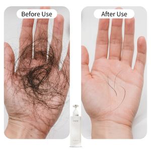 Vente en gros 250g de shampooing bio <span class=keywords><strong>anti</strong></span>-<span class=keywords><strong>chute</strong></span> de cheveux avec logo personnalisé shampooing <span class=keywords><strong>efficace</strong></span> pour le contrôle de la <span class=keywords><strong>chute</strong></span> des cheveux de marque privée - Product Image 3