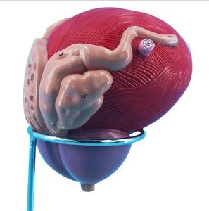 Modelo <span class=keywords><strong>de</strong></span> Agrandamiento <span class=keywords><strong>de</strong></span> <span class=keywords><strong>la</strong></span> <span class=keywords><strong>Vejiga</strong></span> Masculina del Sistema Genitourinario, Modelo Estructural con Orificios Uretrales y Glándula Prostática - Product Image 4