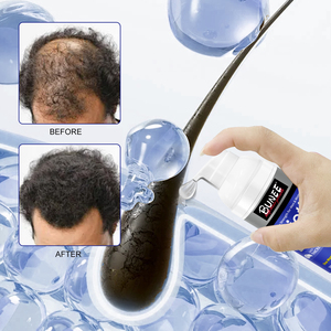 Huile de croissance capillaire anti-chute et régénérante, traitement aux vitamines, nouvelle lotion-gel capillaire pour hommes et femmes - Product Image 1