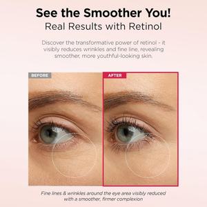 Soin de la peau coréen, lissage, raffermissement, réduction des ridules, anti-âge, anti-rides, sérum facial pur à 0,1 % pour le visage - Product Image 6