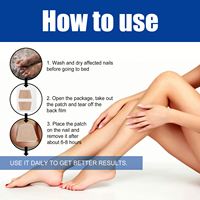 Patchs de réparation rapide et efficace pour les ongles des pieds Ximonth, multi-usages, traitement des ongles incarnés, bandes de traitement des champignons des ongles, patch de correction des ongles des pieds