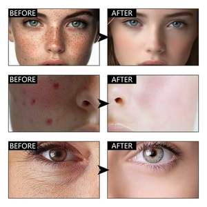 Skincare <b>Serum</b> Niacinamide 35% Super Strength <b>Serum</b> Brightening Hydrating <b>Face</b> <b>Serum</b> Evens Skin Tone Fast Absorb All Skin Types - Product Image 5