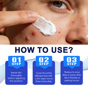 Crème ATOANY Soin Rapide Confort & Renouvellement pour la folliculite et l'acné avec 1% d'acide salicylique + extraits <span class=keywords><strong>de</strong></span> plantes pour le cuir chevelu, le visage et le corps - Product Image 5