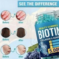 Gummies à la biotine, au collagène et à la kératine - Complément vitaminique pour les cheveux, la peau et les ongles - Soutien beauté à croquer pour des cheveux forts et brillants
