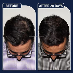 Los Mejores Productos <span class=keywords><strong>para</strong></span> <span class=keywords><strong>el</strong></span> Crecimiento del Cabello, Tratamiento <span class=keywords><strong>para</strong></span> la Caída del Cabello, Spray <span class=keywords><strong>para</strong></span> <span class=keywords><strong>el</strong></span> Crecimiento del Cabello FEG - Product Image 5