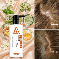 Shampooing Antichute Végétalien Naturel à l'Extrait de Centella Asiatica Sans Sulfate (Sans SLS/SLES) 2-EN-1 Parfum Frais Nettoyage en Profondeur Contre les Démangeaisons