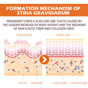 2024รอยแผลเป็นจากการแตกลายที่ได้รับความนิยมมากครีมนวดเพื่อลดริ้วรอยต่างๆให้ผิวเรียบเนียน - Product Image 5