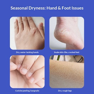 Японский крем от трещин на пятках <span class=keywords><strong>Dingding</strong></span> с маслом авокадо, увлажняющий и предотвращающий обморожение, для защиты от обморожения. - Product Image 2