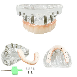 Modelos Dentales de Resina a Precio de Fábrica, Modelos de Implantes Dentales Maxilares y Dentaduras Postizas Reutilizables para Entrenamiento y Uso Educativo - Product Image 1