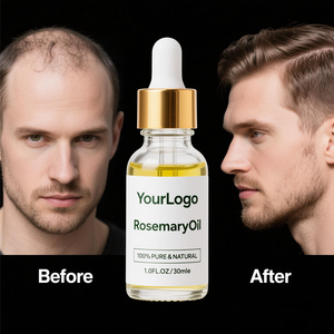 น้ำมันปลูกผมโรสแมรี่อาร์แกนน้ำมันปลูกผมสินค้าเฉพาะบำรุงหนังศีรษะออแกนิก - Product Image 6