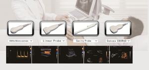 Ecógrafo Doppler Color Portátil GCP-E30, Escáner Médico Humano para Abdomen, Obstetricia/Ginecología, Cardiología, Vascular, Órganos Pequeños - Product Image 3
