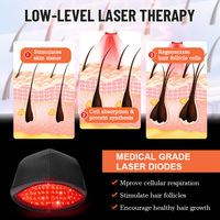 Approvisionnement d'usine : Casque laser portable à lumière rouge 650nm avec 272 diodes, dispositif de photothérapie LLLT pour le soin du cuir chevelu, traitement de la perte de cheveux pour hommes et femmes
