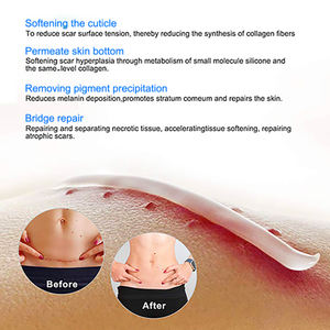 Best Sell Gel per la rimozione delle cicatrici trattamento per l'acne cicatrici sbiancanti crema Gel per la cura crema per il viso a base di erbe per adulti e lozione crema per la vitiligine - Product Image 4