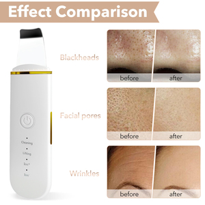 Custom Logo Ultrasonic Handheld Facial <b>Exfoliator</b> 4 Modes White Plastic Face Lifting Cleaner With Ion Technology - Product Image 3