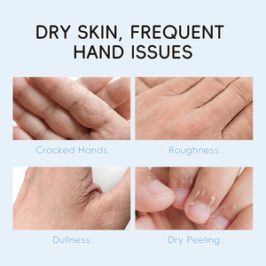 Crème pour les mains au lait LAIKOU, crème anti-fissures pour les mains, 50 g, crème nourrissante anti-gerçures pour les mains - Product Image 4