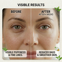 Sérum Roll-on pour les Yeux au Collagène Végétalien Marque Blanche Anti-Âge Anti-Rides Acide Hyaluronique Traitement Anti-Poches et Cernes