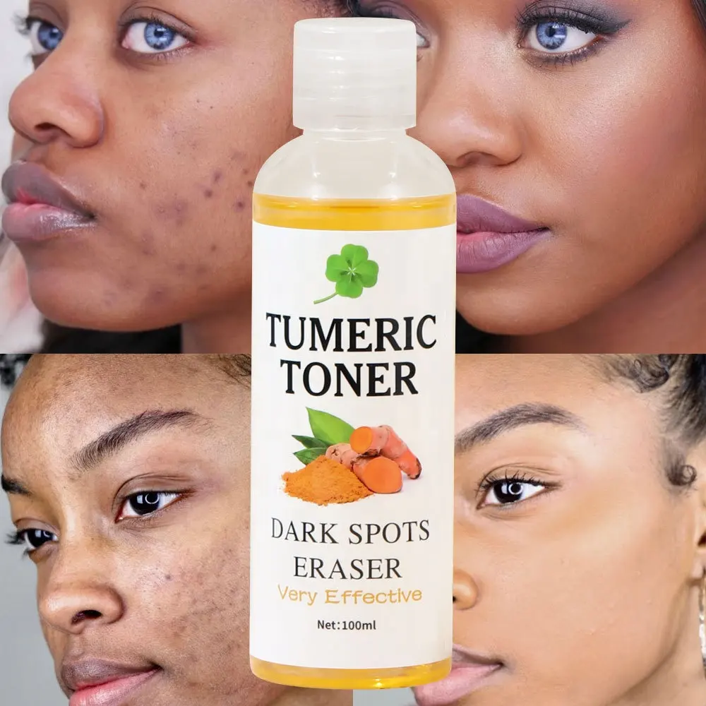 Natural Organic Facial Skin Care Removes Dark Spots Moisturizing Nourishing Repair Acne Turmeric Face Toner
