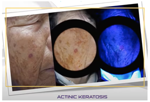 Yüksek kaliteli Pet ahşap lamba | Ringworm ve cilt hastalığı algılama için profesyonel UV ışık | Taşınabilir tip-c şarj edilebilir tasarım - Product Image 6