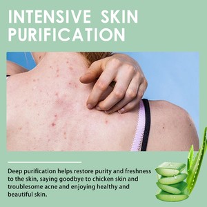 <span class=keywords><strong>ครีม</strong></span>รักษาสิวสำหรับทำความสะอาดร่างกายอย่างล้ำลึกขนาด48กรัม - Product Image 5