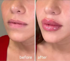 Voluminizador de Labios con Ácido Hialurónico de Efecto Instantáneo, Multicolor, Tono Rosa Natural, Marca Blanca al por Mayor - Product Image 6