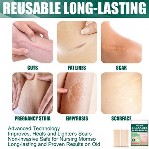 Vente en gros EELHOE feuille silicone pour cicatrices patch coupe les lignes graisseuses <span class=keywords><strong>grossesse</strong></span> strie empyrose traitement feuilles de gel de silicone pour cicatrices - Product Image 4