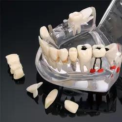 Modelo de dientes <span class=keywords><strong>para</strong></span> enseñanza Dental y entrenamiento - Product Image 5