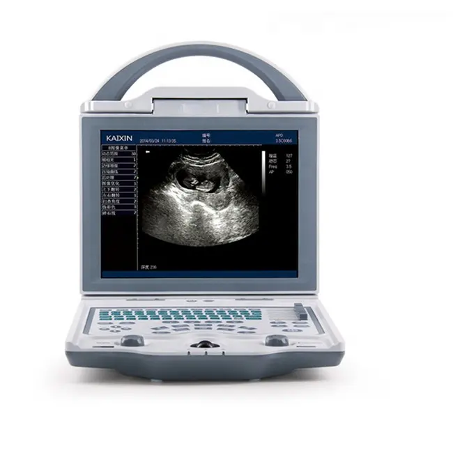 पोर्टेबल पेशेवर गर्भावस्था परीक्षण पशु चिकित्सा अल्ट्रासाउंड स्कैनर सस्ती कीमत