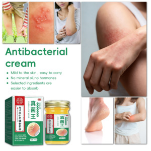 Nanjing Tongrentang Fungus King's Plant Crema antipruriginosa para el cuidado del cuerpo Crema para el cuidado <span class=keywords><strong>de</strong></span> manos y pies en stock - Product Image 5
