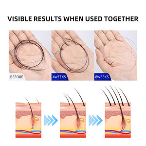 Sérum capillaire activateur <span class=keywords><strong>de</strong></span> follicules pour les racines fragiles, solution épaississante pour cheveux, shampoing pour stimuler la croissance des cheveux pour hommes et femmes - Product Image 5