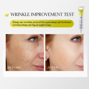 Crème réparatrice pour les <span class=keywords><strong>yeux</strong></span> SIEESA, crème <span class=keywords><strong>anti</strong></span>-rides pour les <span class=keywords><strong>yeux</strong></span> au rétinol, raffermissante, réduit les cernes, les ridules et les poches sous les <span class=keywords><strong>yeux</strong></span> - Product Image 4