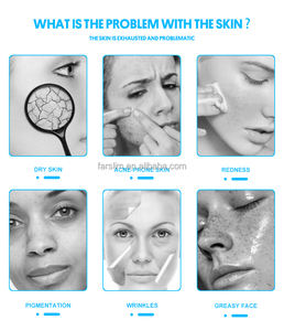 2025 Hydra Dermabrasion H2O2 Jet Peel Belleza facial Spa Cuidado DE LA PIEL Cara Firm <span class=keywords><strong>Hidro</strong></span> Microdermabrasion Aqua Salon Hydro Machine - Product Image 5