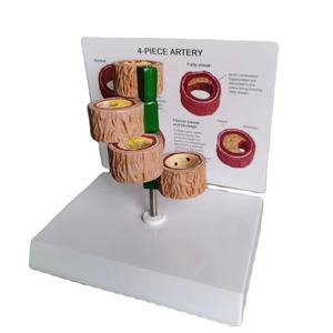 4 buah Model demonstrasi trombus arteri manusia sains medis Model penyakit manusia - Product Image 1