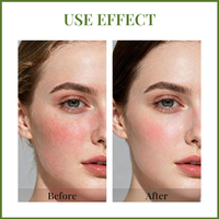 Masque facial à l'acide hyaluronique, hydratation intense, réparation post-laser, réparation de la barrière cutanée pour peaux sensibles, usage professionnel en clinique