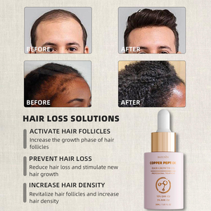 Özel Marka Vegan Doğal Organik Saç Dökülmesini Önleyici ve Yeniden Çıkaran Esansiyel Yağ Biberiye Bakır Peptit Saç Onarıcı Yağ Kontrolü - Product Image 4