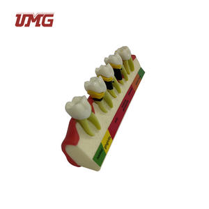 Tandheelkundige Studiemodellen Classificatiemodel Parodontitis - Product Image 3