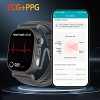 Montre connectée personnalisée 2026 avec logo, suivi de santé, surveillance du sommeil, ECG+HRV, écran AMOLED, suivi d'activité IP68, appels directes